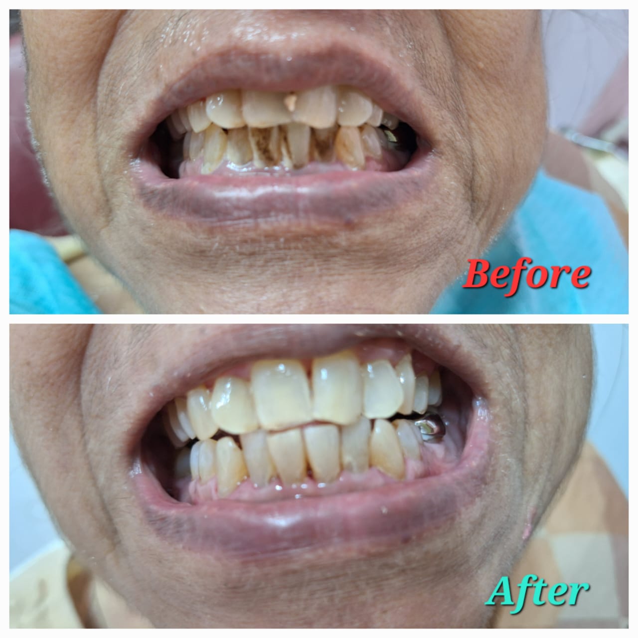 Before or after image - REPLACE_ME