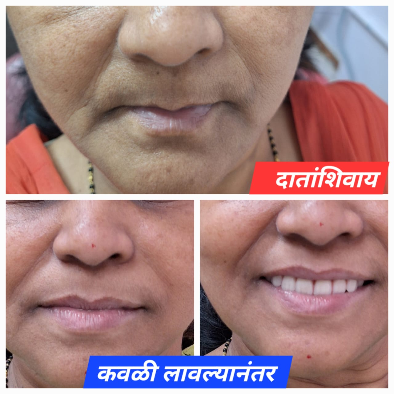 Before or after image - REPLACE_ME