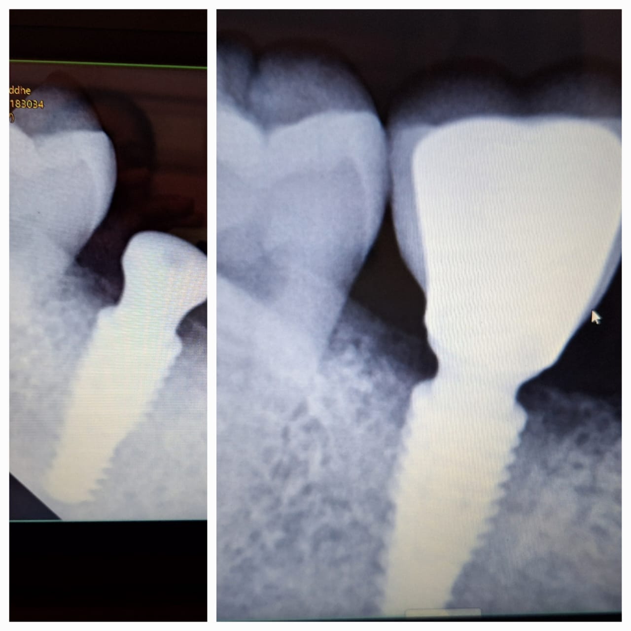 Before or after image - REPLACE_ME