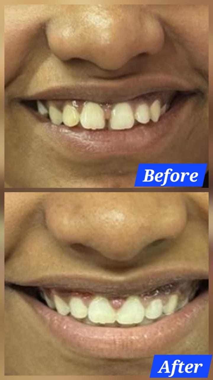 Before or after image - REPLACE_ME